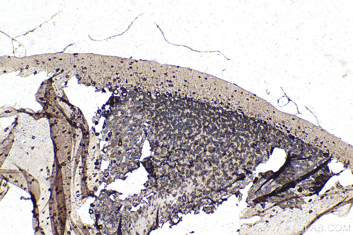 Immunohistochemistry (IHC) staining of rat cerebellum tissue using PRKRA Monoclonal antibody (68518-1-Ig)