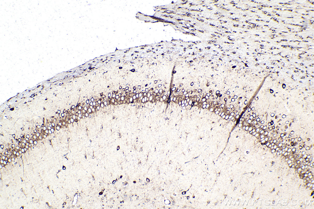 Immunohistochemistry (IHC) staining of rat brain tissue using PRKRA Monoclonal antibody (68518-1-Ig)