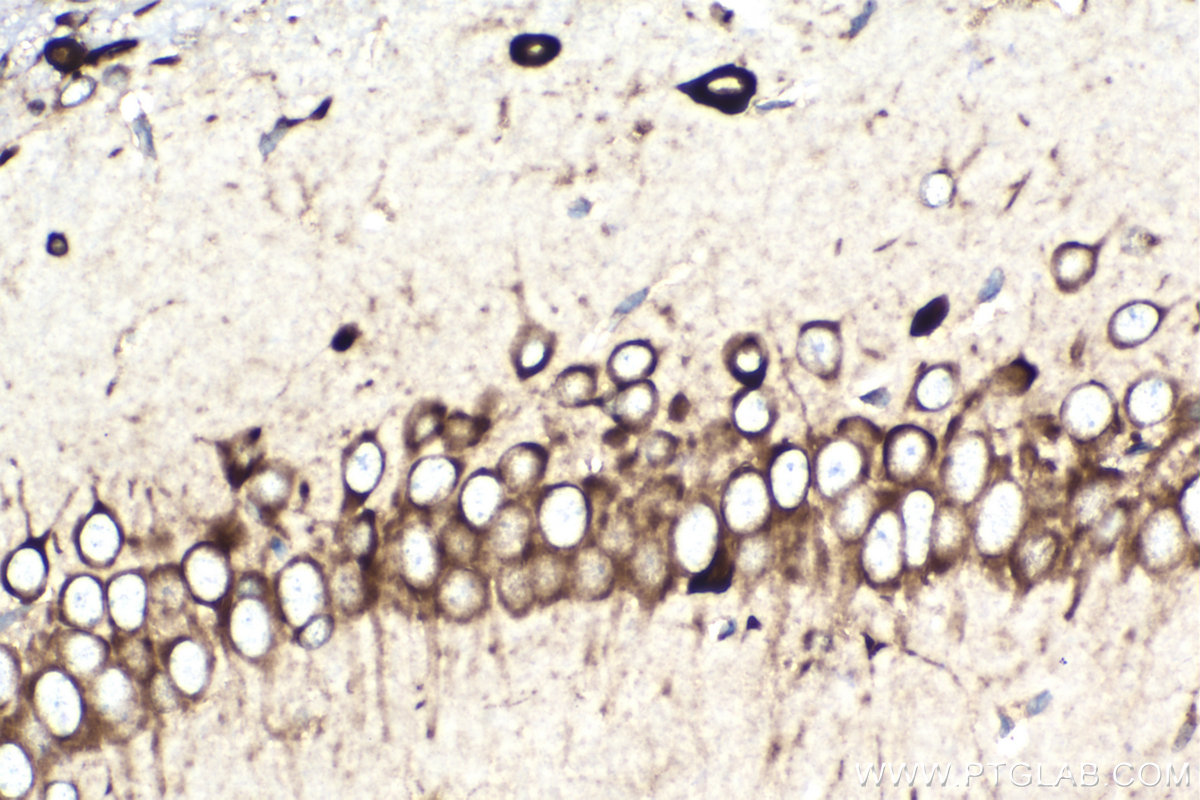 Immunohistochemistry (IHC) staining of rat brain tissue using PRKRA Monoclonal antibody (68518-1-Ig)