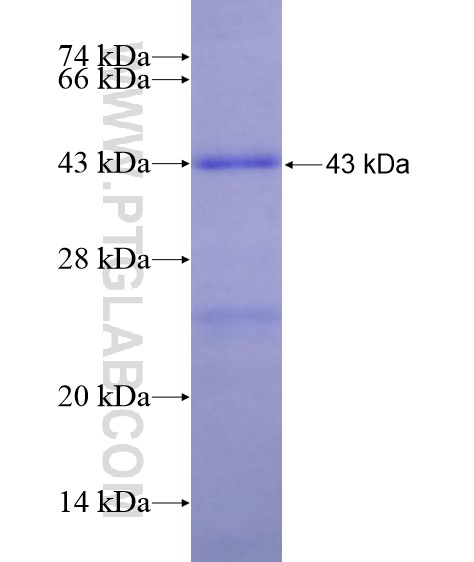 PRMT1 fusion protein Ag29063 SDS-PAGE
