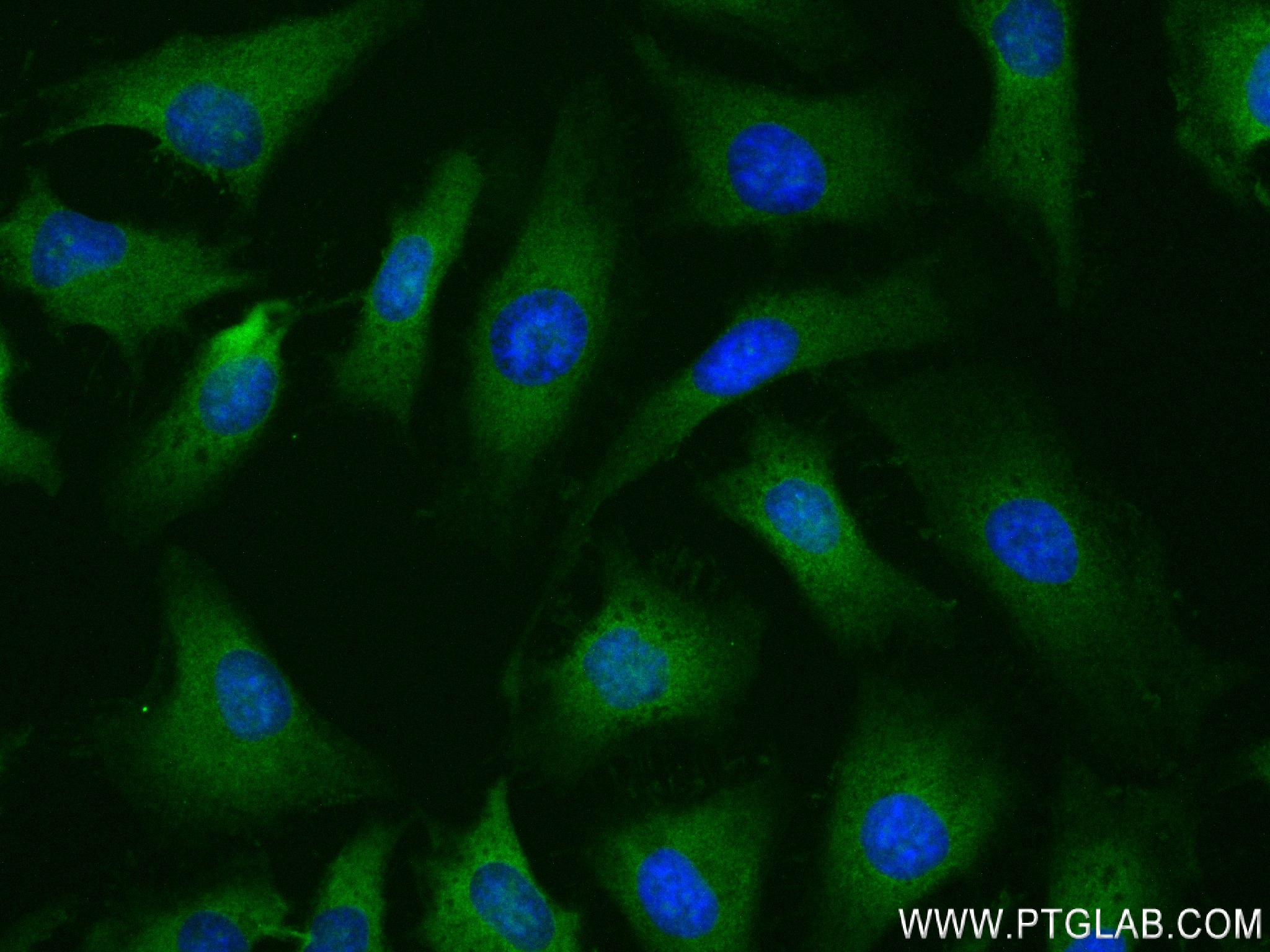 Immunofluorescence (IF) / fluorescent staining of HeLa cells using PRMT3 Recombinant antibody (83969-3-RR)