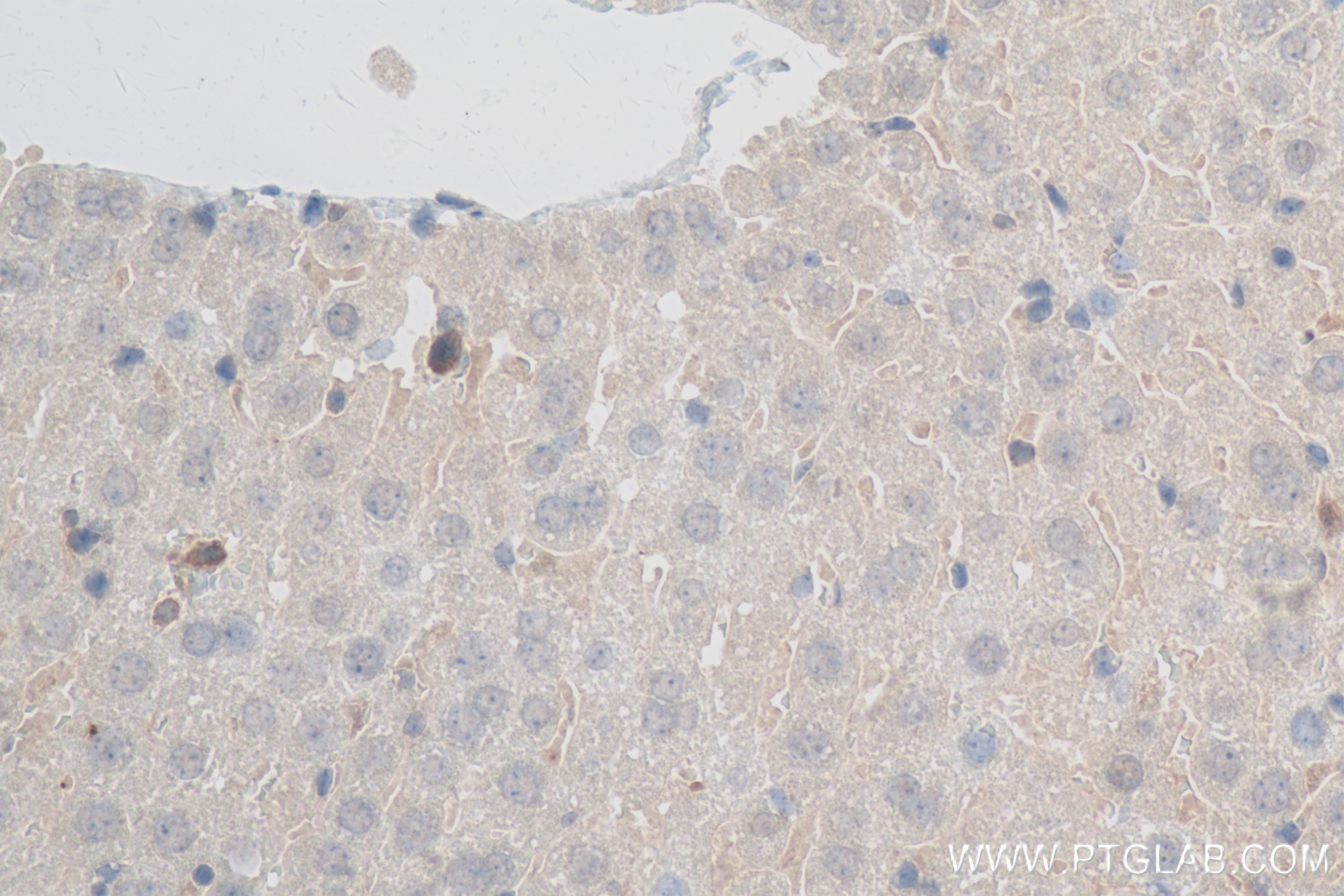 Immunohistochemistry (IHC) staining of mouse liver tissue using PRMT3 Recombinant antibody (83969-6-RR)