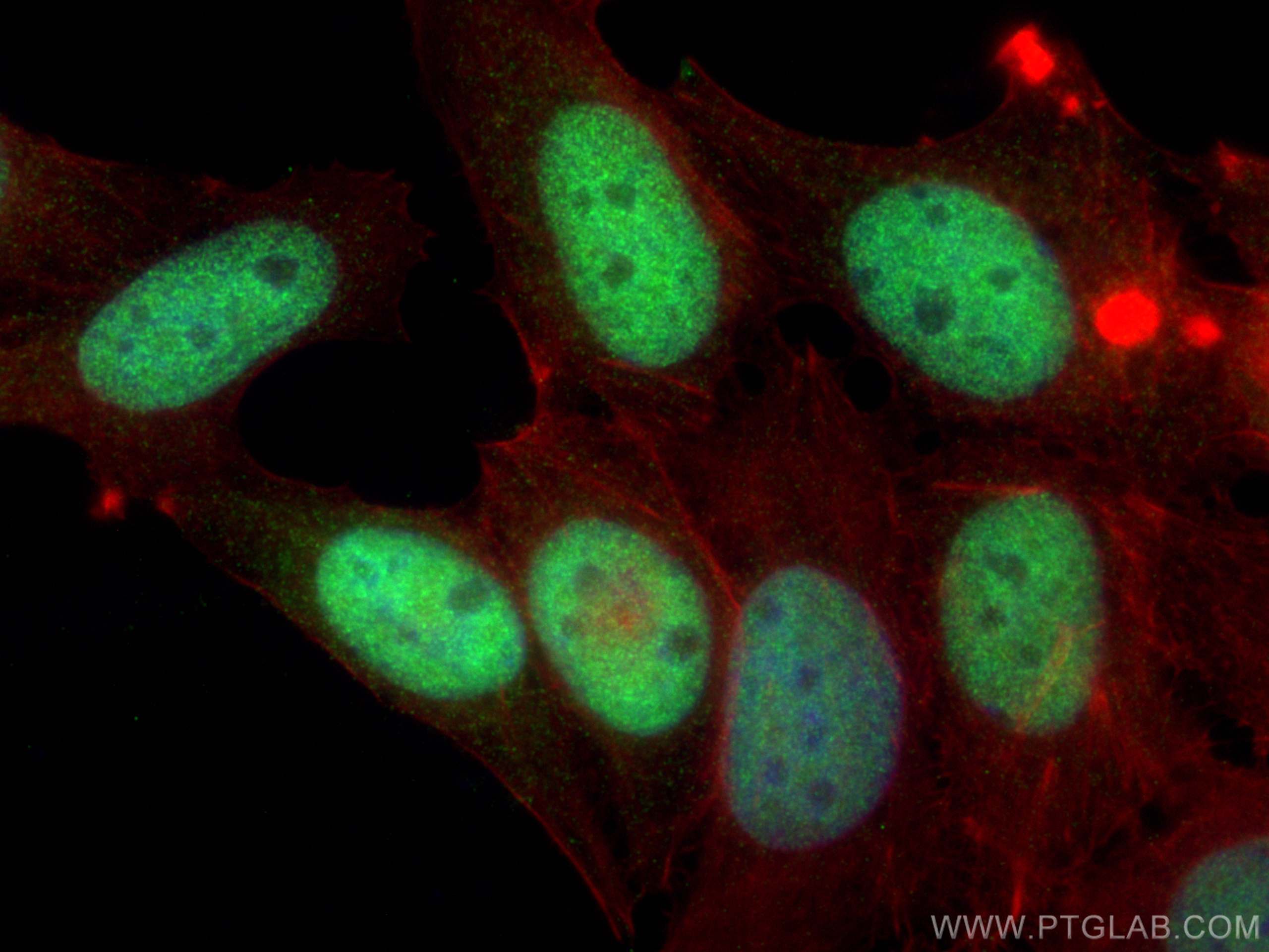 Immunofluorescence (IF) / fluorescent staining of MCF-7 cells using PRMT6 Polyclonal antibody (15395-1-AP)