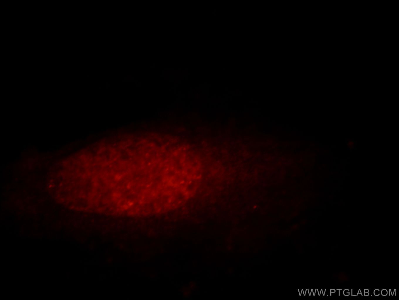 Immunofluorescence (IF) / fluorescent staining of HeLa cells using PRO1768 Polyclonal antibody (21061-1-AP)