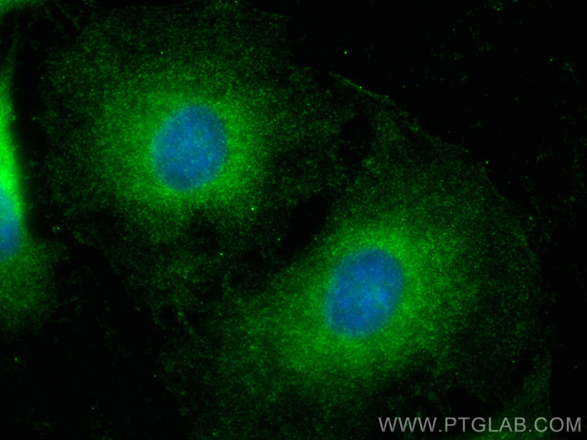 Immunofluorescence (IF) / fluorescent staining of HeLa cells using PROC Polyclonal antibody (25382-1-AP)