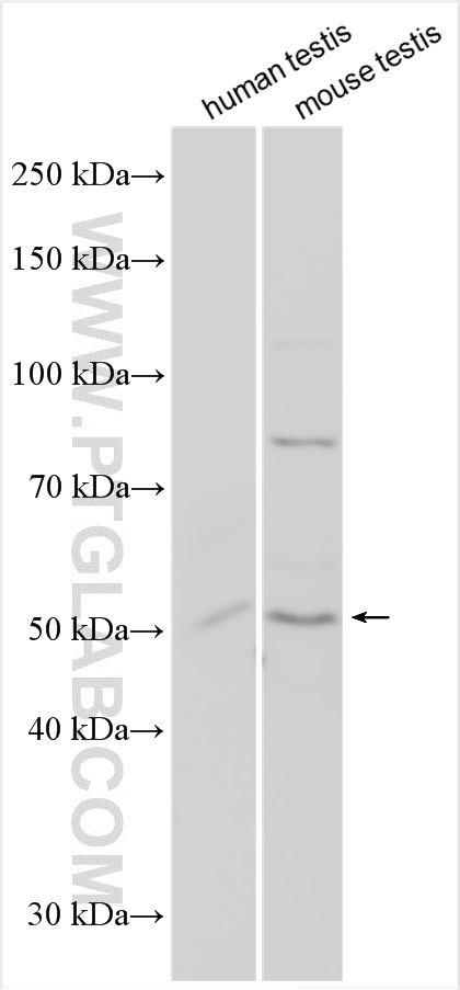 Western Blot (WB) analysis of various lysates using PRODH2 Polyclonal antibody (31047-1-AP)