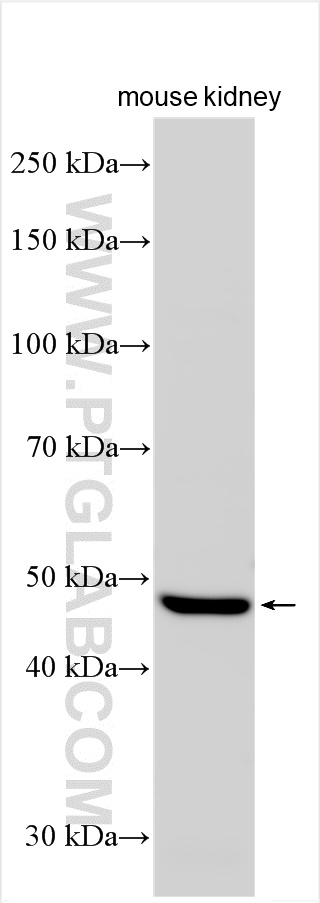 Western Blot (WB) analysis of various lysates using PRODH2 Polyclonal antibody (31047-1-AP)