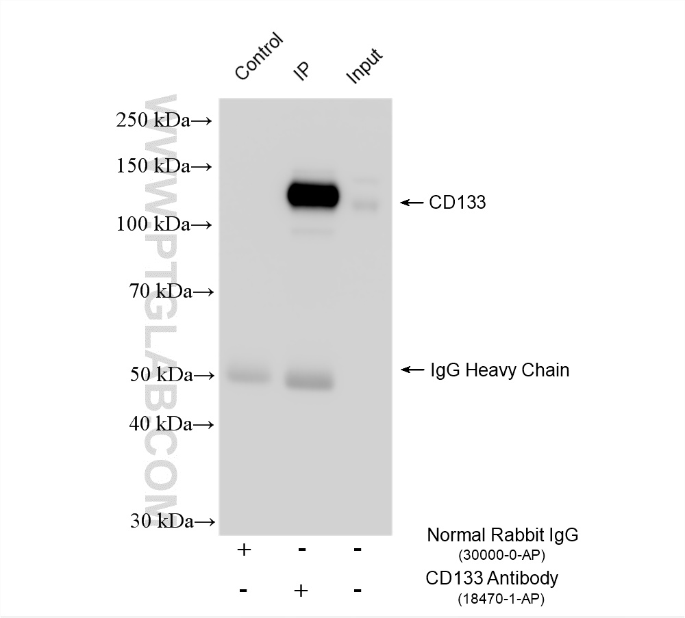 Immunoprecipitation (IP) experiment of HT-29 cells using CD133 Polyclonal antibody (18470-1-AP)