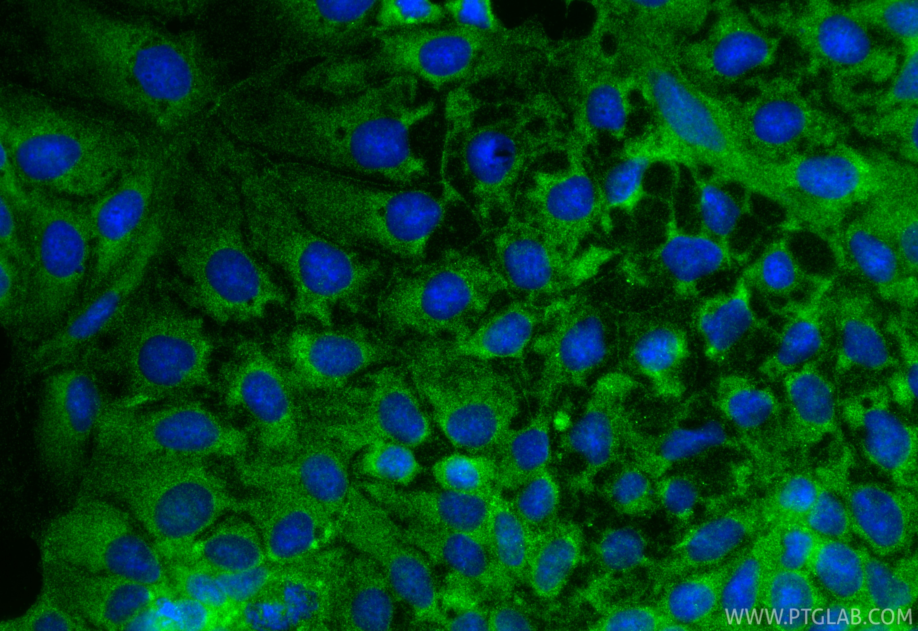 Immunofluorescence (IF) / fluorescent staining of Caco-2 cells using CD133 Polyclonal antibody (18495-1-AP)
