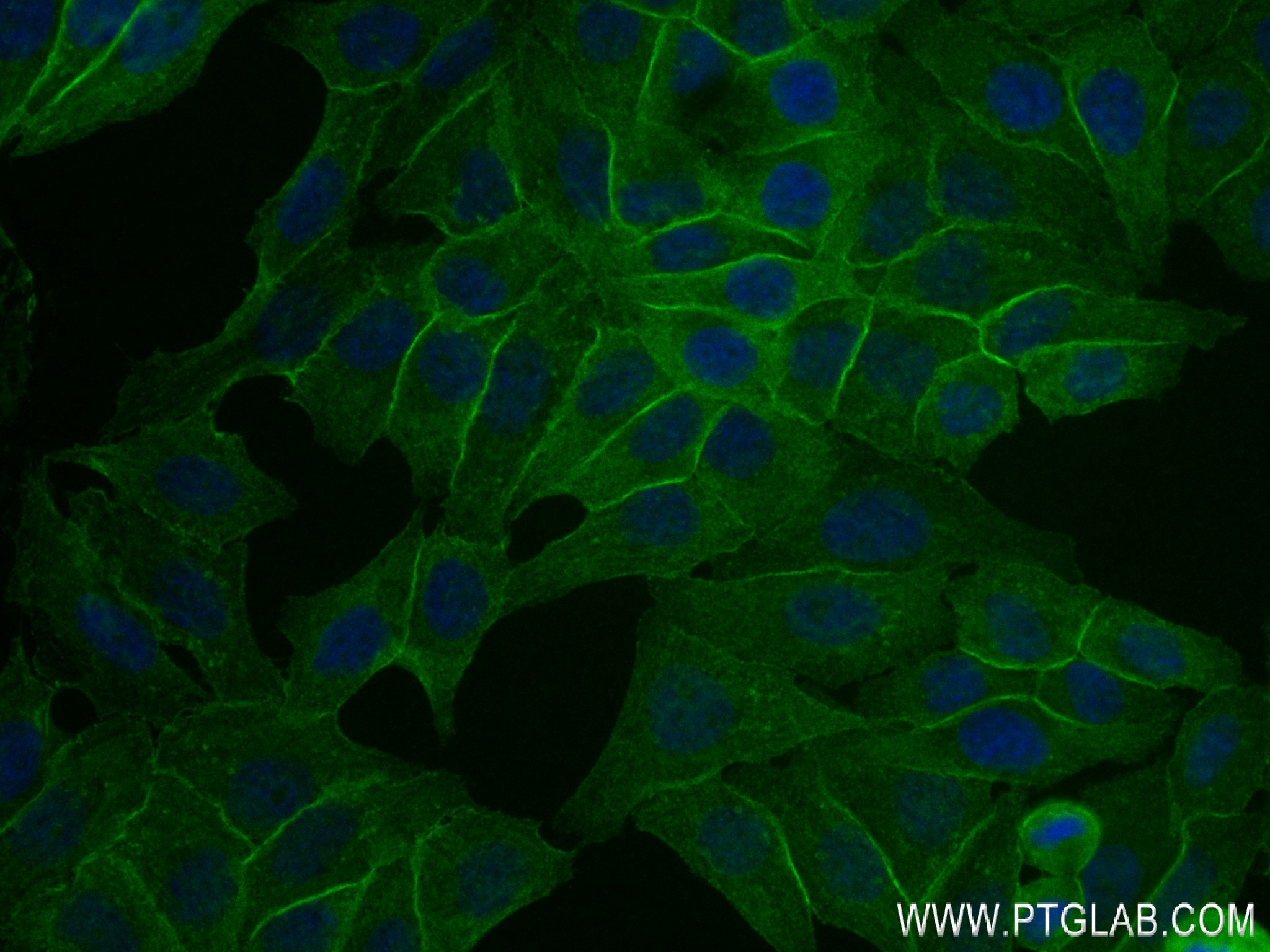 Immunofluorescence (IF) / fluorescent staining of HepG2 cells using PROS1 Recombinant antibody (84107-2-RR)