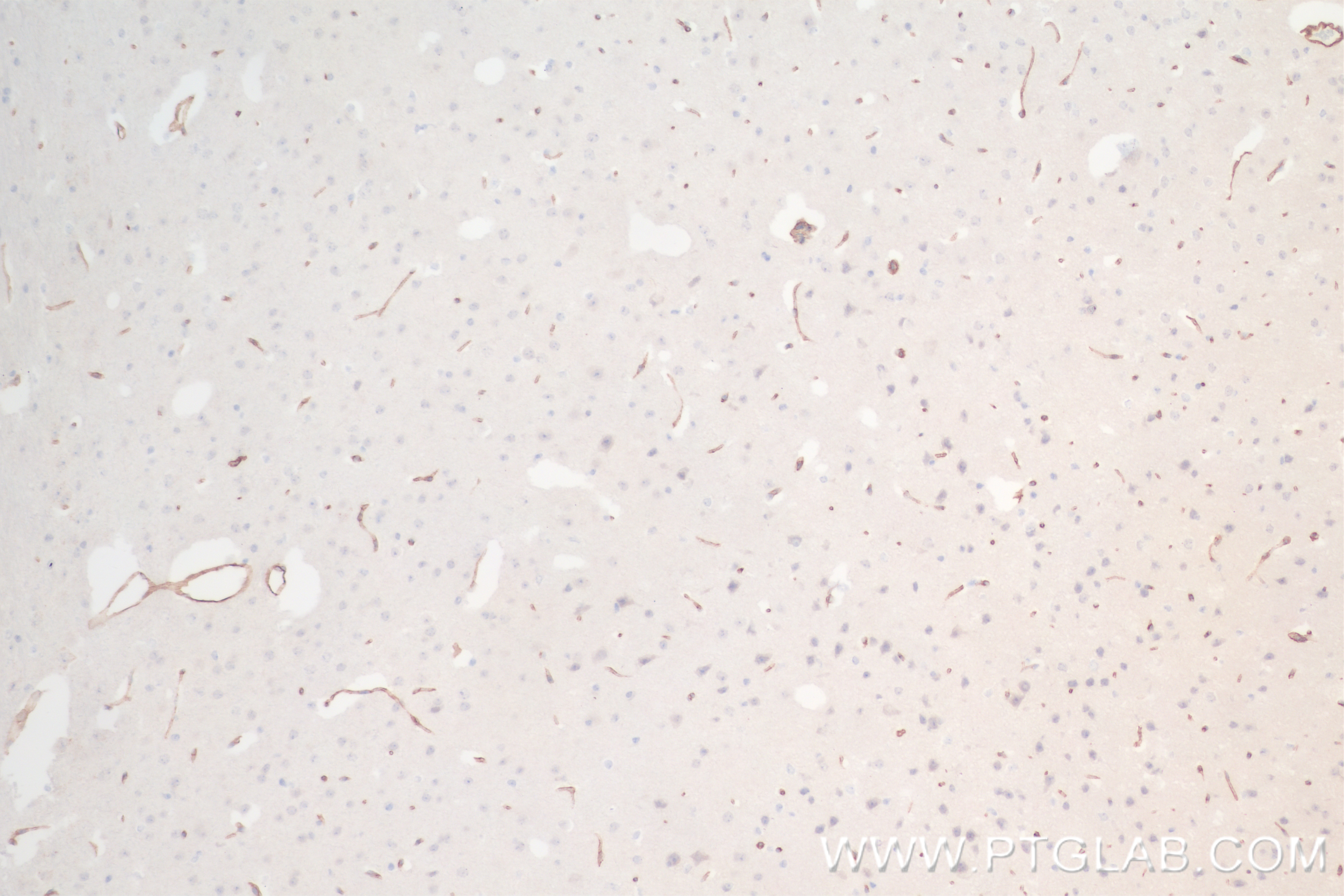 Immunohistochemistry (IHC) staining of mouse brain tissue using PROS1 Recombinant antibody (84107-2-RR)