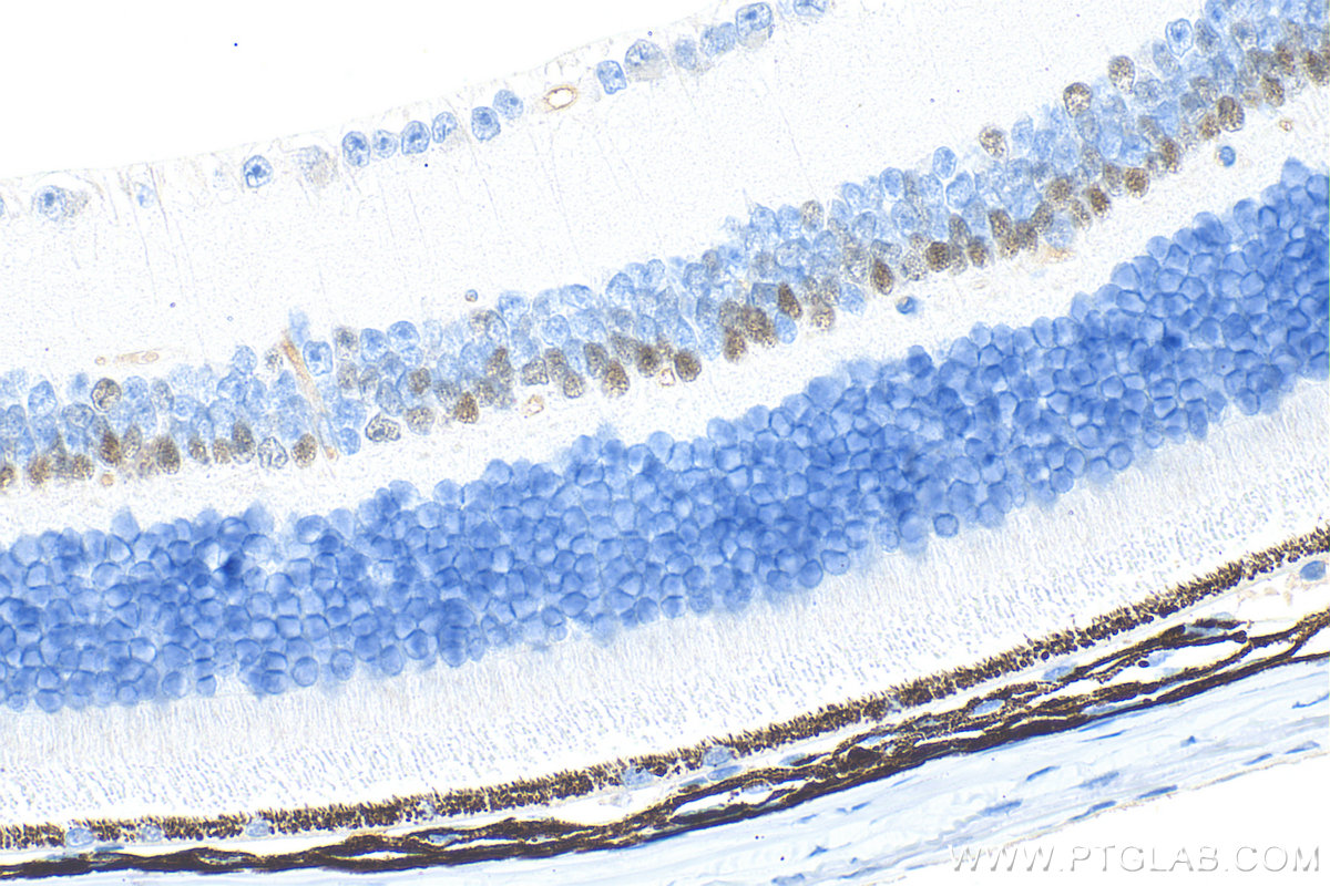 Immunohistochemistry (IHC) staining of mouse eye tissue using PROX1 Monoclonal antibody (67438-1-Ig)