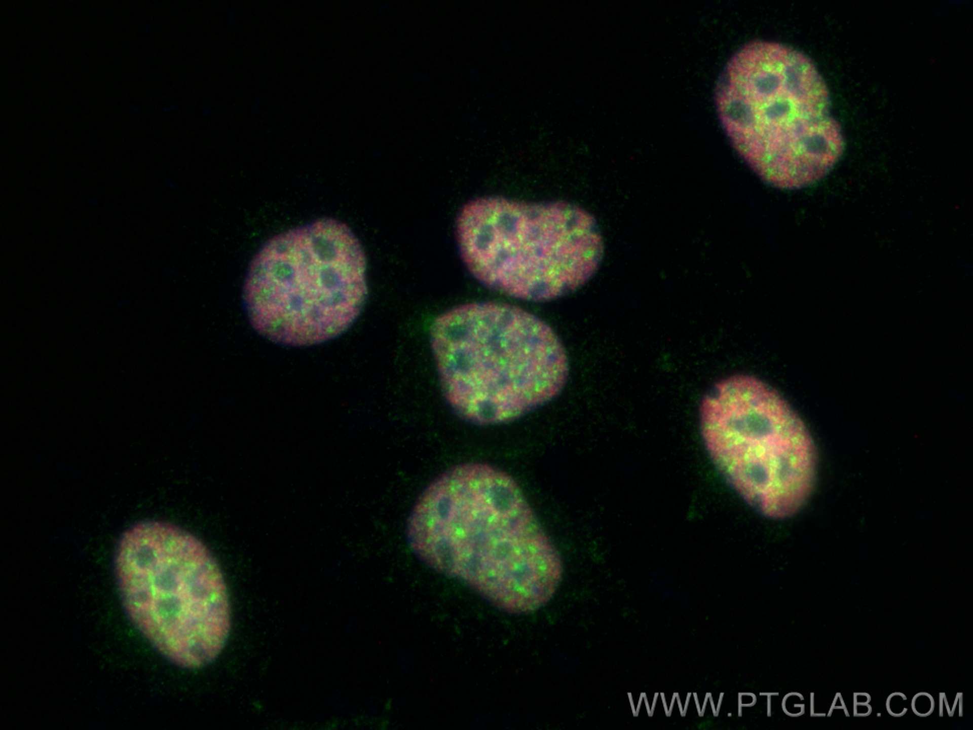 Immunofluorescence (IF) / fluorescent staining of HuH-7 cells using PROX1 Recombinant antibody (81778-1-RR)