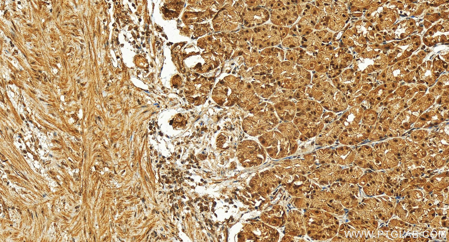 Immunohistochemistry (IHC) staining of human stomach tissue using PRPF19 Polyclonal antibody (15414-1-AP)