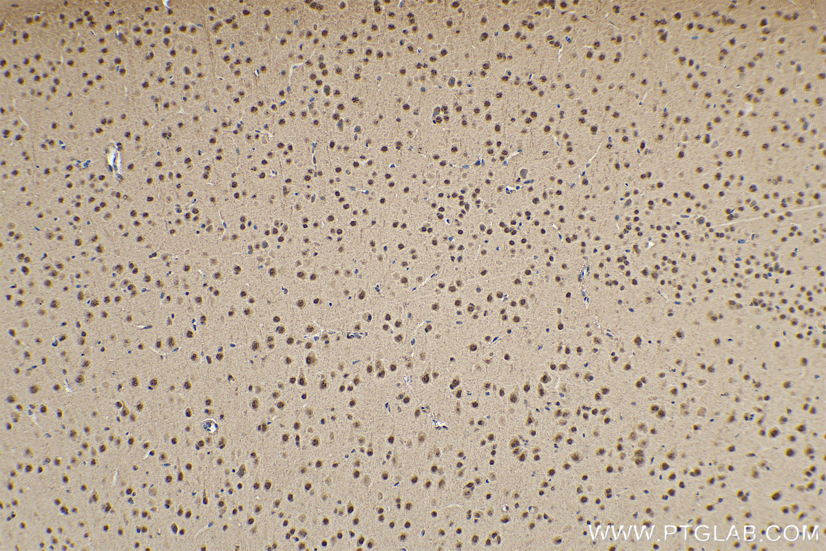 Immunohistochemistry (IHC) staining of mouse brain tissue using PRPF8 Polyclonal antibody (11171-1-AP)