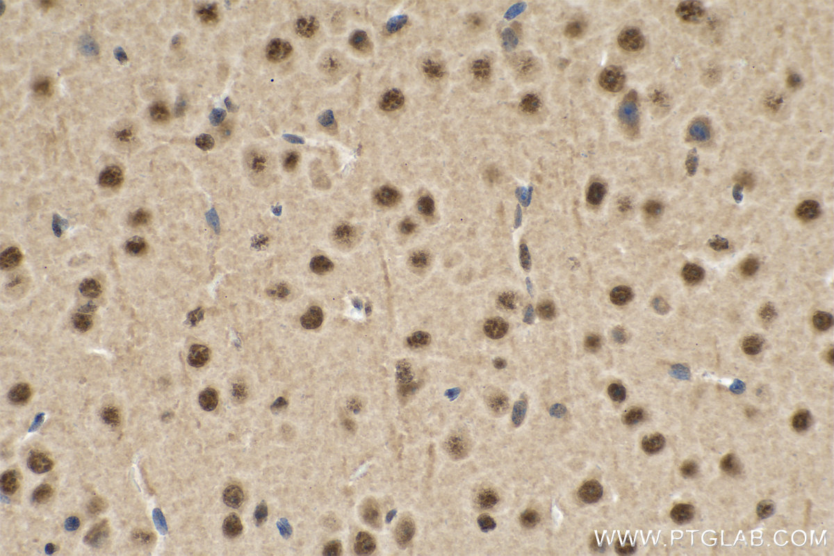 Immunohistochemistry (IHC) staining of mouse brain tissue using PRPF8 Polyclonal antibody (11171-1-AP)