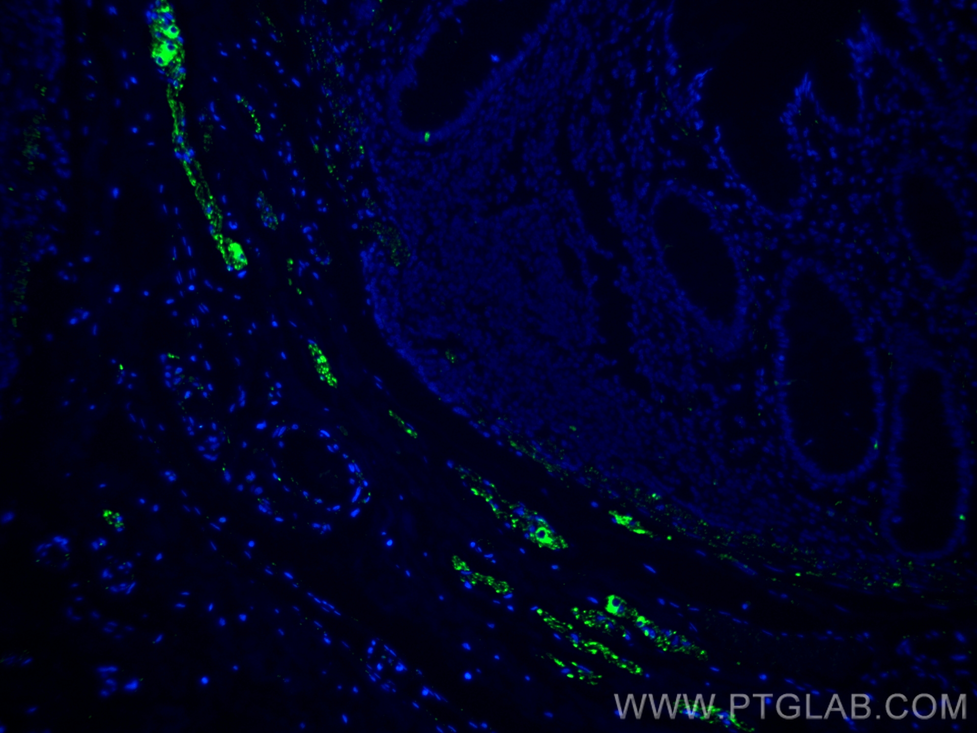 Immunofluorescence (IF) / fluorescent staining of human colon tissue using Peripherin Polyclonal antibody (17399-1-AP)