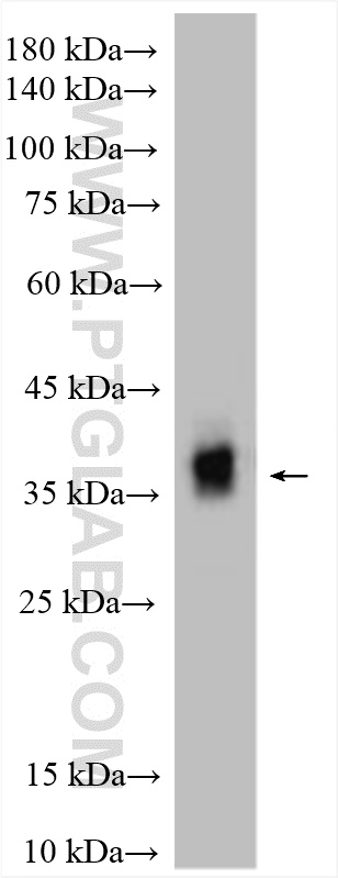 Western Blot (WB) analysis of mouse eye tissue using PRPH2 Polyclonal antibody (18109-1-AP)