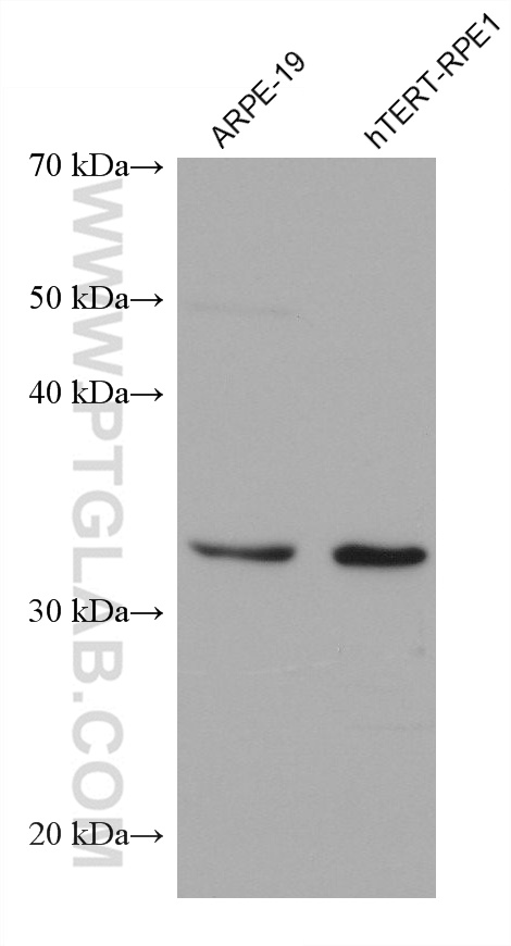 Western Blot (WB) analysis of various lysates using PRPH2 Monoclonal antibody (68780-1-Ig)