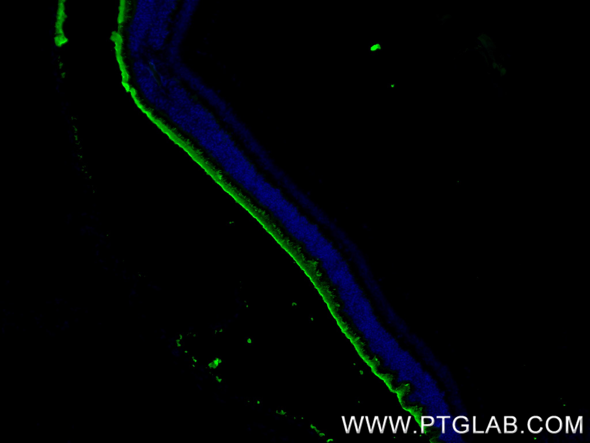 Immunofluorescence (IF) / fluorescent staining of mouse eye tissue using PRPH2 Recombinant antibody (85043-1-RR)