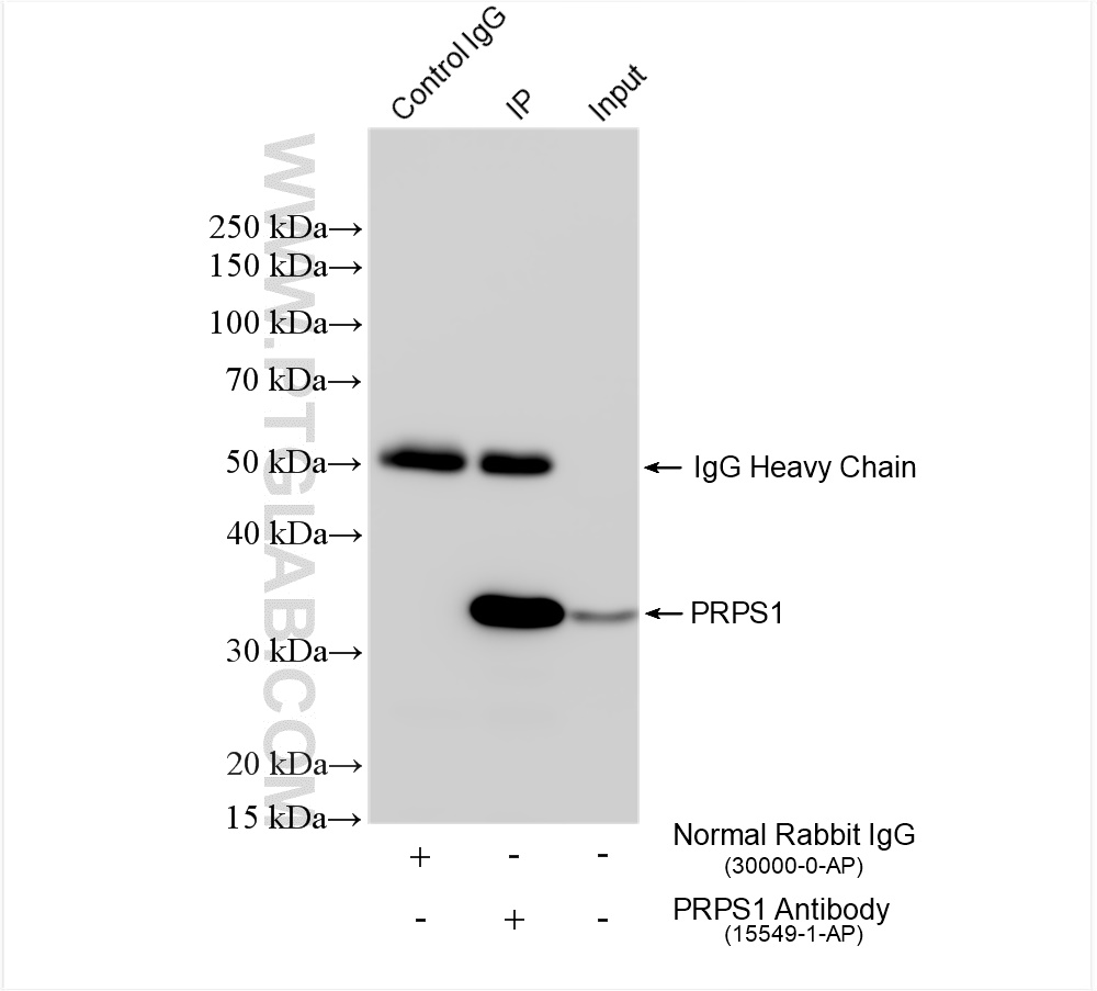 Immunoprecipitation (IP) experiment of HeLa cells using PRPS1 Polyclonal antibody (15549-1-AP)