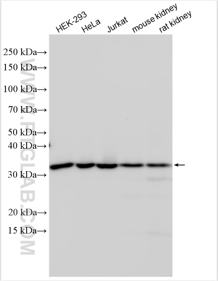 Western Blot (WB) analysis of various lysates using PRPS1 Polyclonal antibody (15549-1-AP)