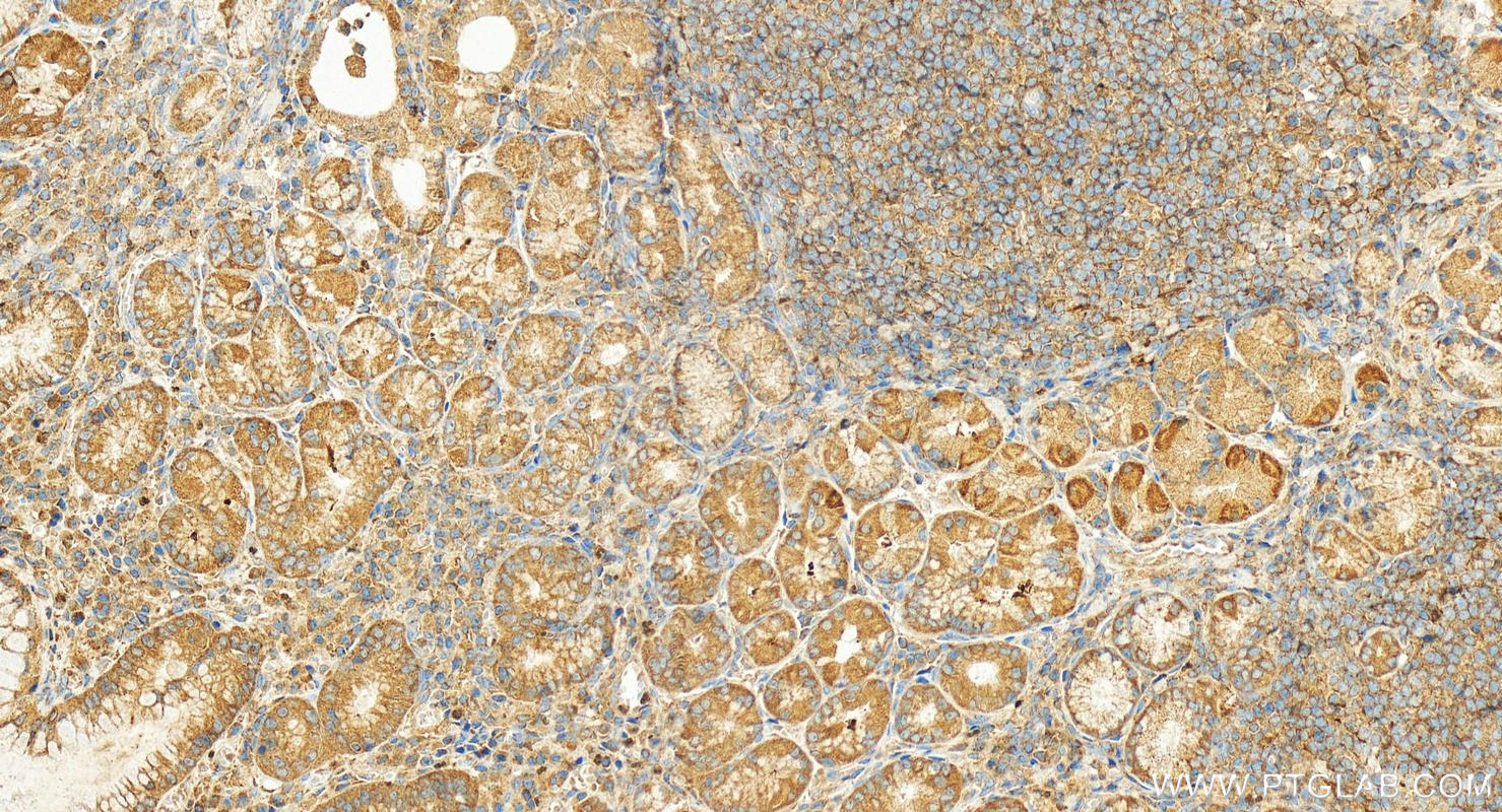 Immunohistochemistry (IHC) staining of human stomach tissue using PRPS2 Polyclonal antibody (27024-1-AP)