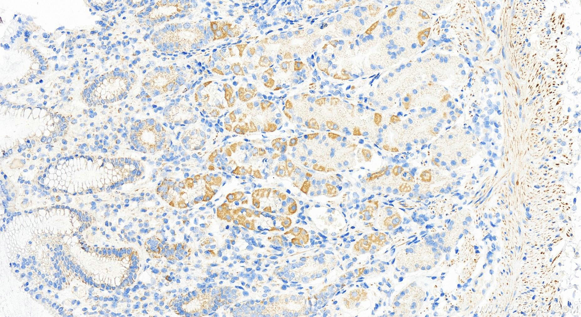 Immunohistochemistry (IHC) staining of human stomach tissue using PRR14 Polyclonal antibody (22819-1-AP)