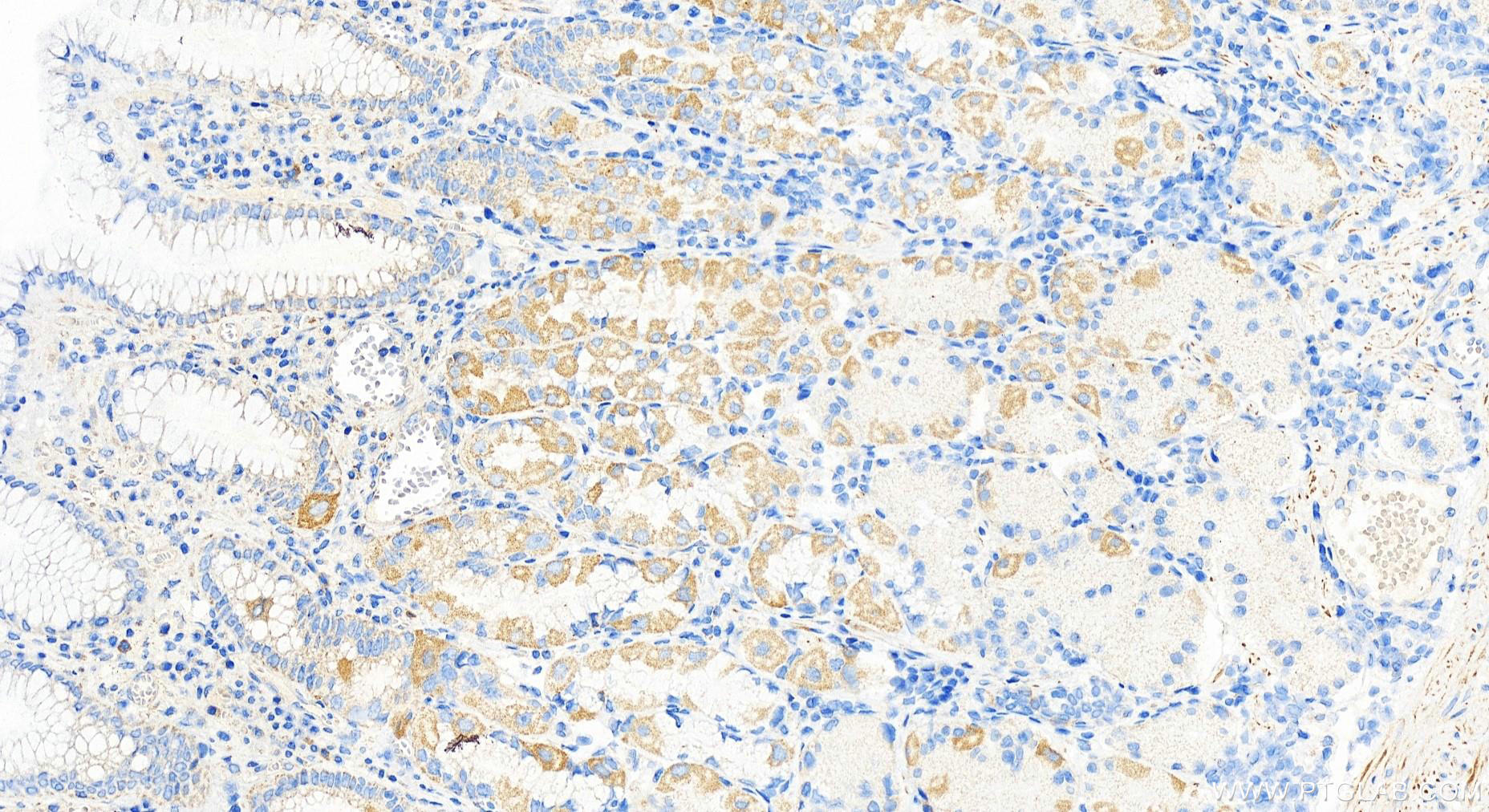 Immunohistochemistry (IHC) staining of human stomach tissue using PRR14 Polyclonal antibody (22819-1-AP)