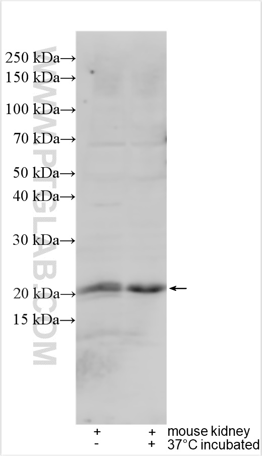 Western Blot (WB) analysis of various lysates using PRRG2 Polyclonal antibody (11618-1-AP)