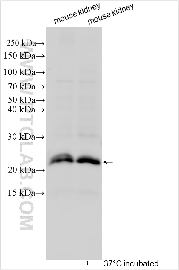 Western Blot (WB) analysis of various lysates using PRRG2 Polyclonal antibody (11618-1-AP)