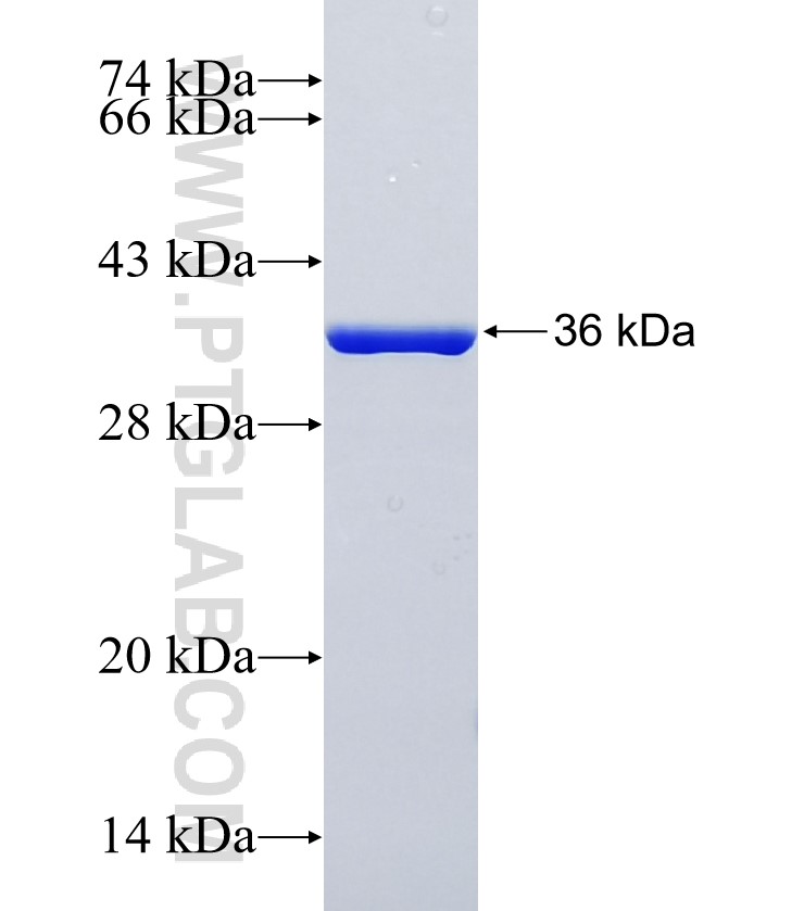 PRRX1 fusion protein Ag21023 SDS-PAGE