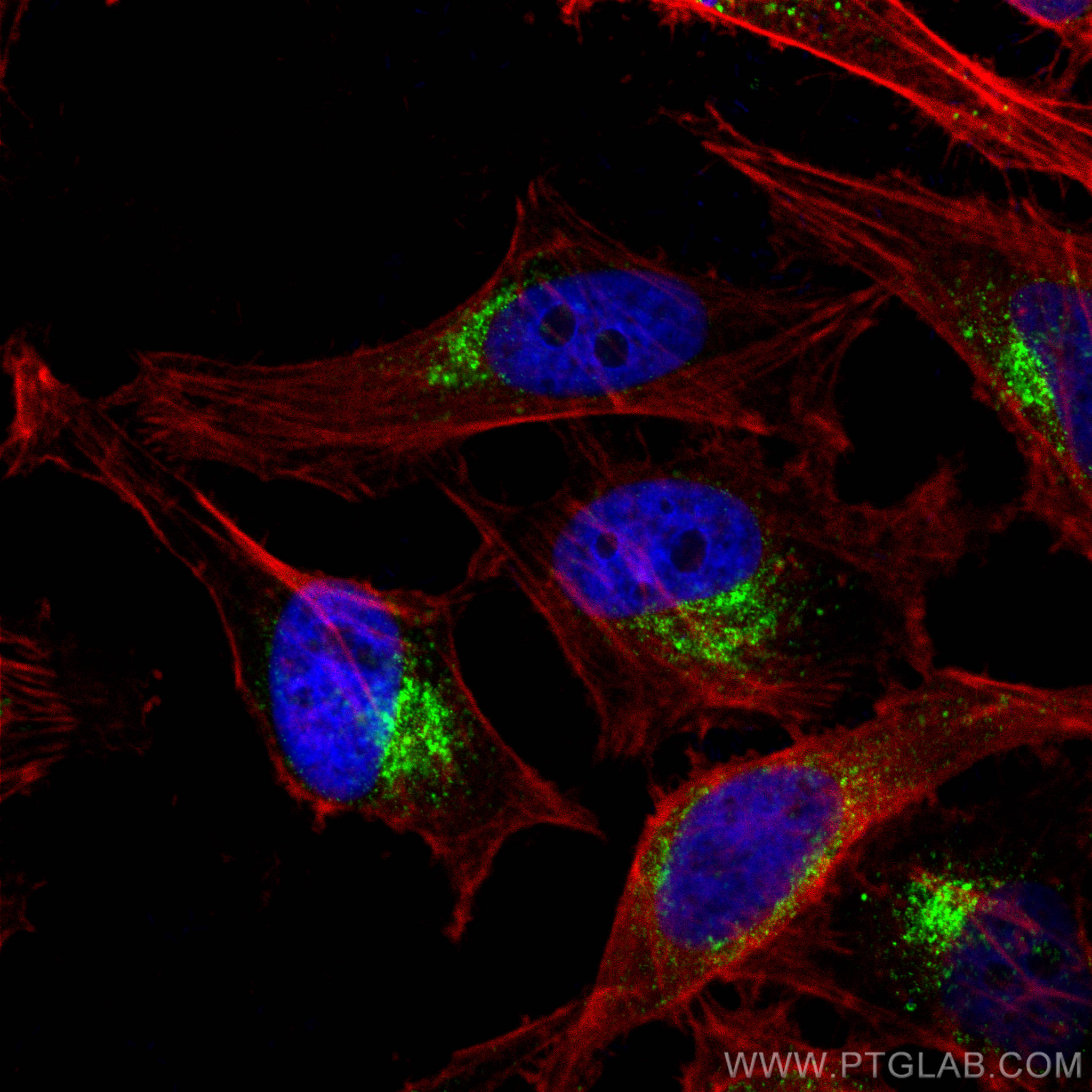 Immunofluorescence (IF) / fluorescent staining of HeLa cells using PSAP Polyclonal antibody (10801-1-AP)