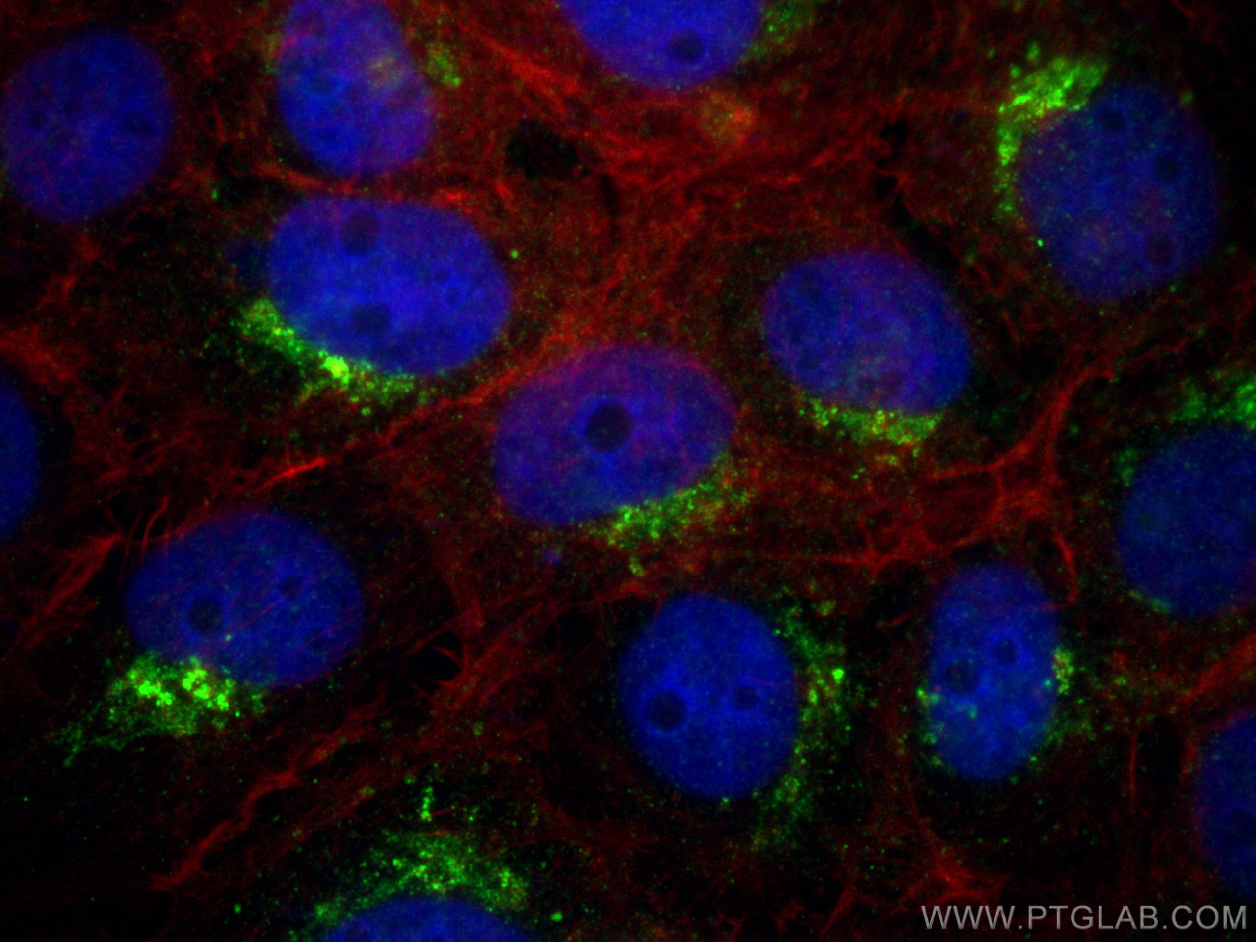 Immunofluorescence (IF) / fluorescent staining of A431 cells using PSAP Polyclonal antibody (18397-1-AP)