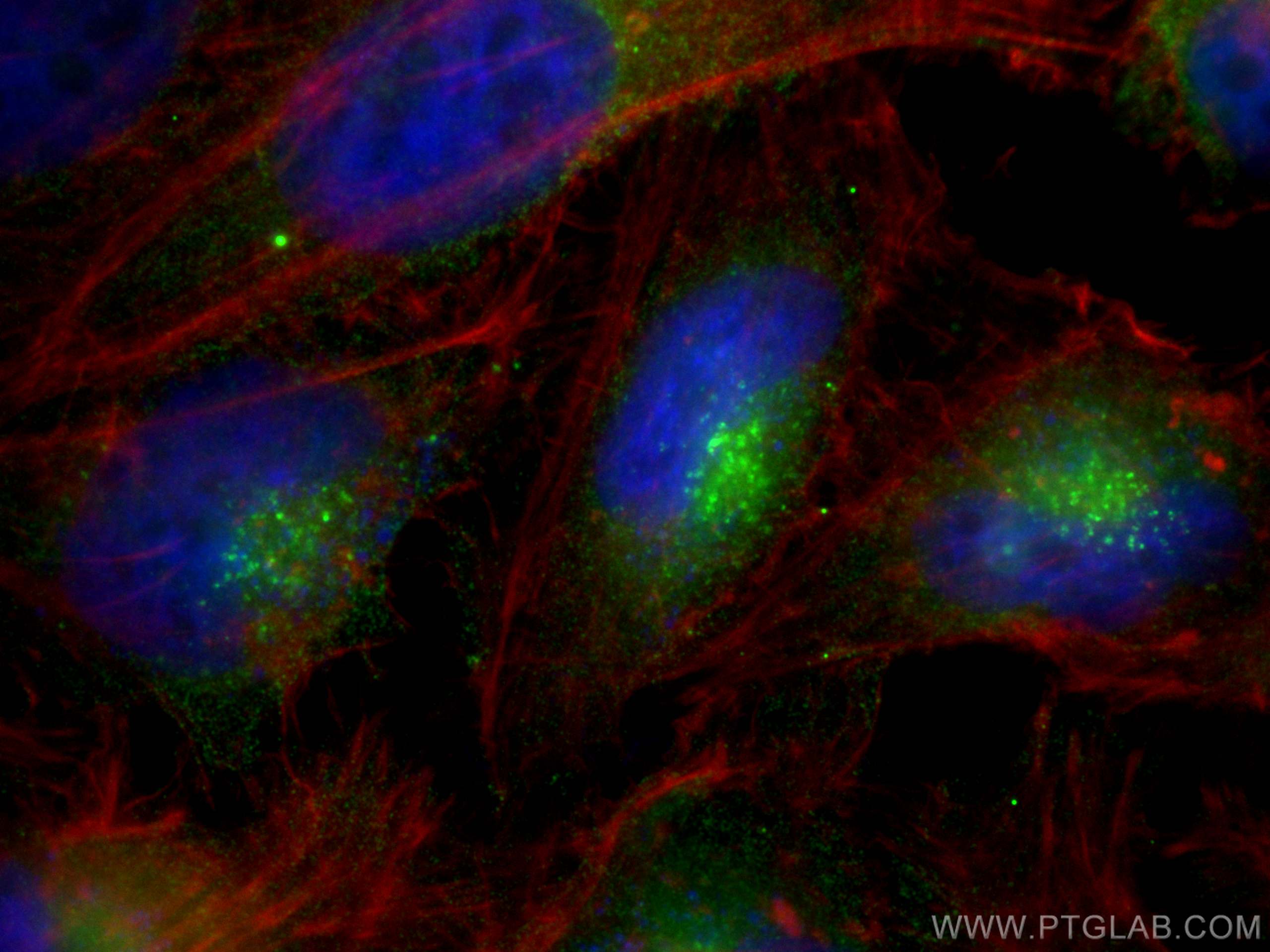 Immunofluorescence (IF) / fluorescent staining of HeLa cells using PSAP Monoclonal antibody (66473-1-Ig)