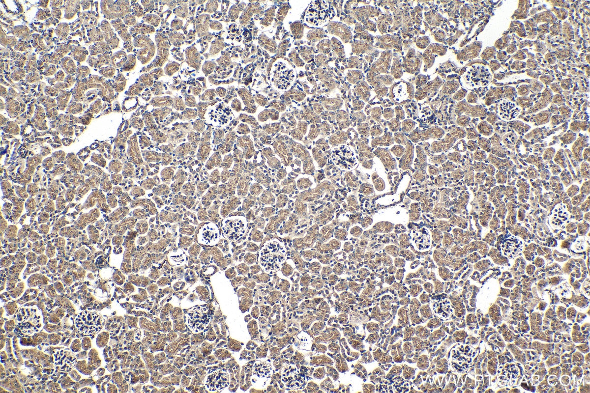 Immunohistochemistry (IHC) staining of mouse kidney tissue using PSAP Monoclonal antibody (66473-1-Ig)
