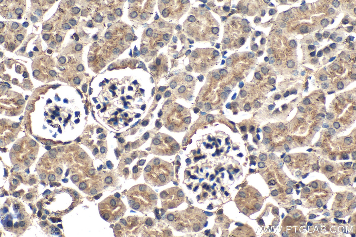 Immunohistochemistry (IHC) staining of mouse kidney tissue using PSAP Monoclonal antibody (66473-1-Ig)