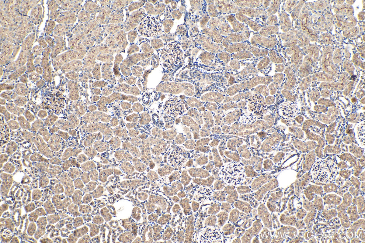 Immunohistochemistry (IHC) staining of rat kidney tissue using PSAP Monoclonal antibody (66473-1-Ig)