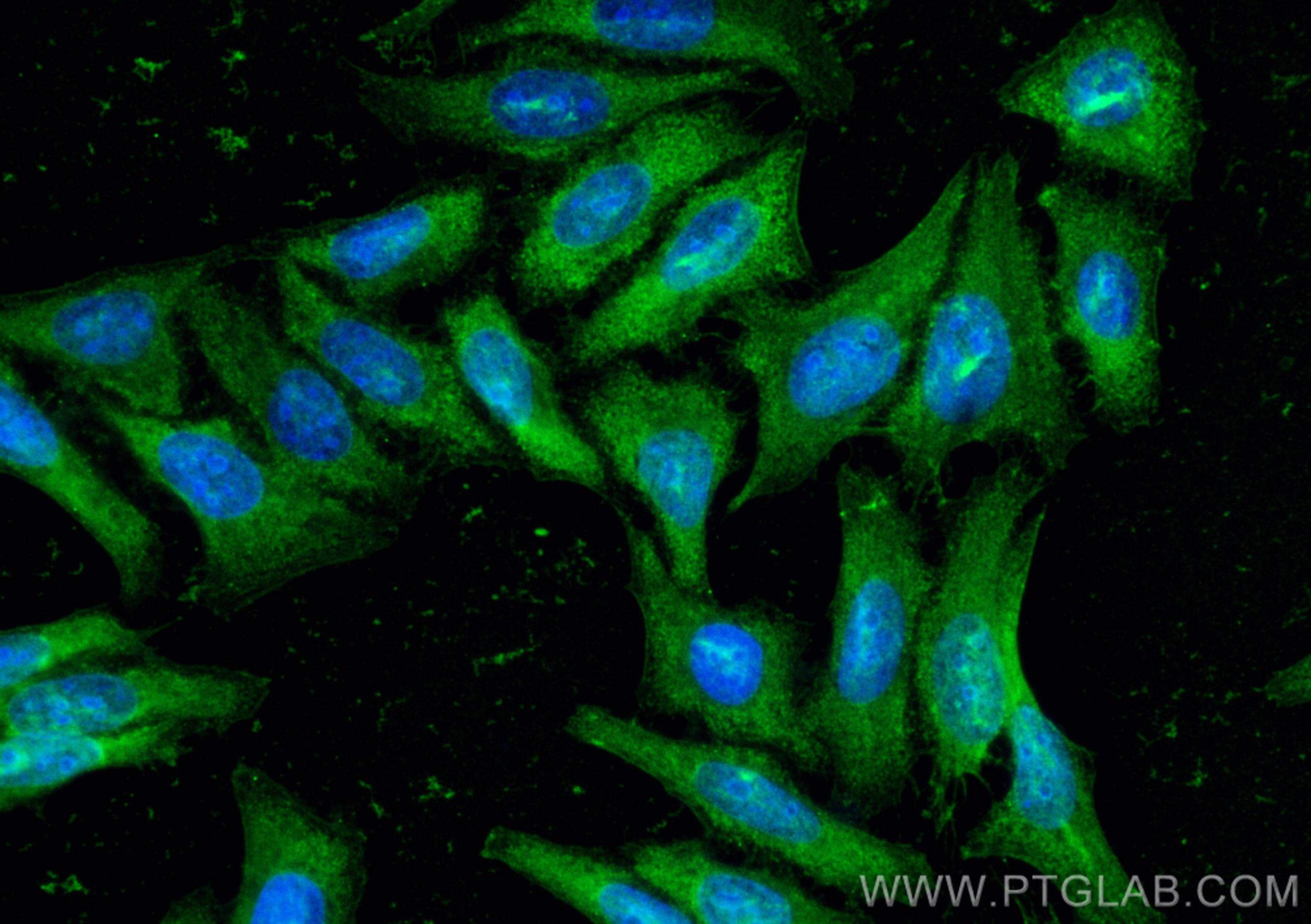 Immunofluorescence (IF) / fluorescent staining of HepG2 cells using PSAT1 Recombinant antibody (81479-1-RR)