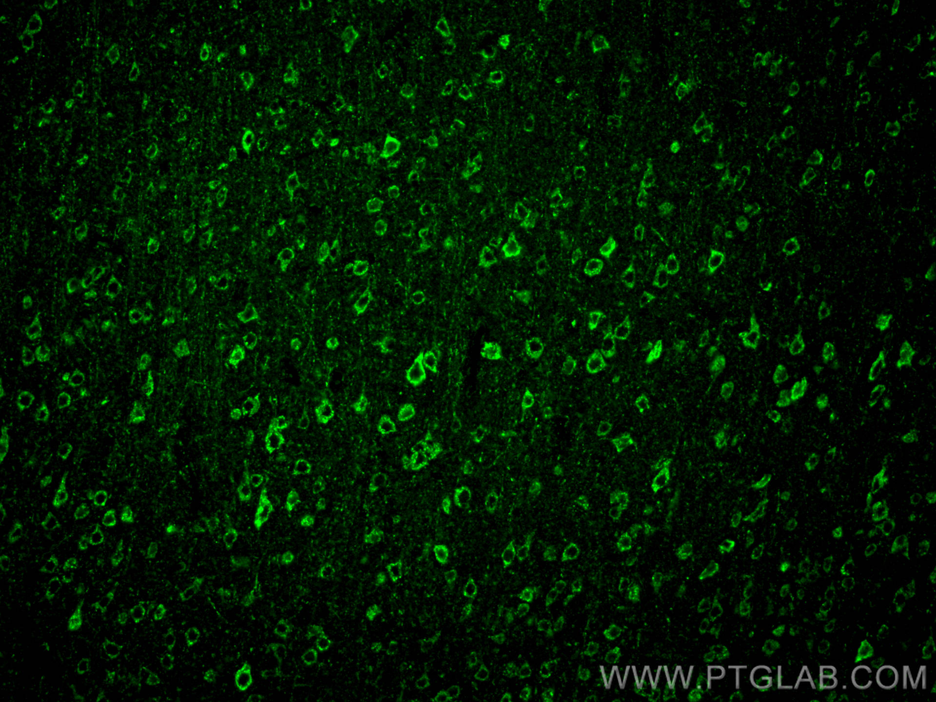 Immunofluorescence (IF) / fluorescent staining of mouse brain tissue using PSD95-Specific,DLG4 Polyclonal antibody (20665-1-AP)