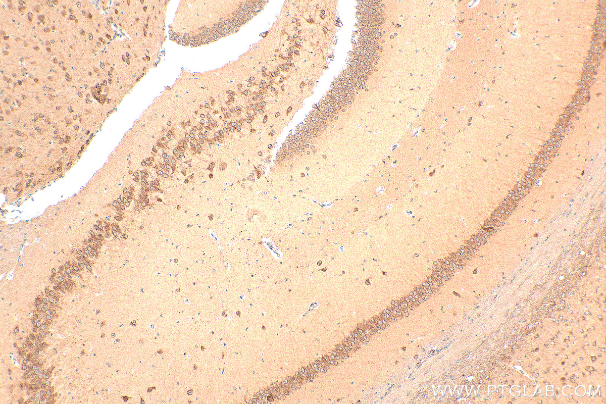 Immunohistochemistry (IHC) staining of mouse brain tissue using PSD95-Specific,DLG4 Polyclonal antibody (20665-1-AP)