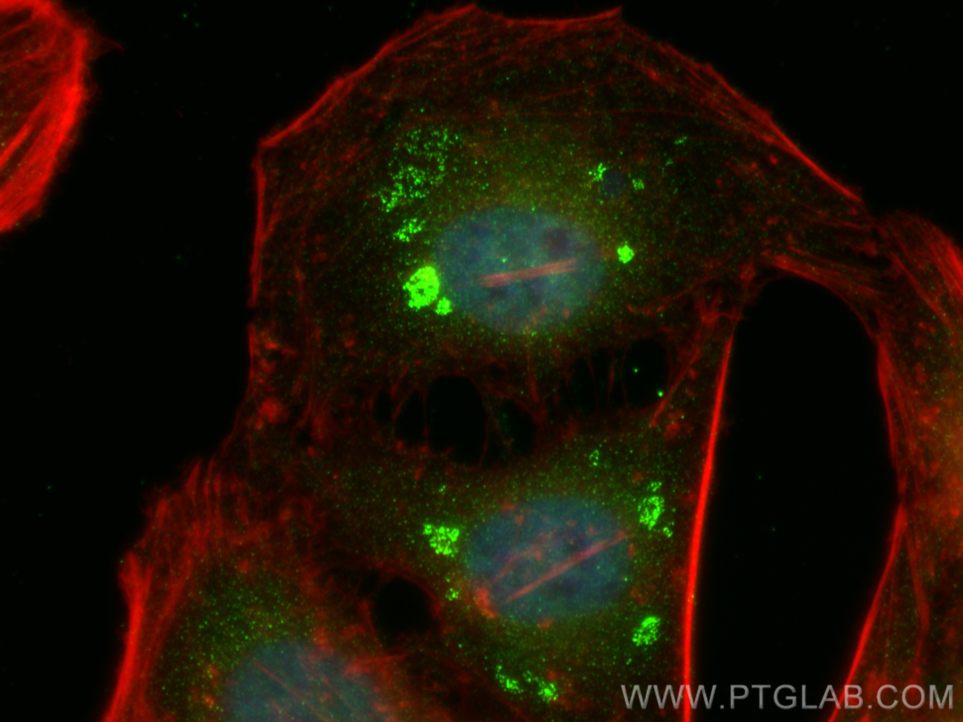 Immunofluorescence (IF) / fluorescent staining of HeLa cells using PSG11 Polyclonal antibody (16352-1-AP)