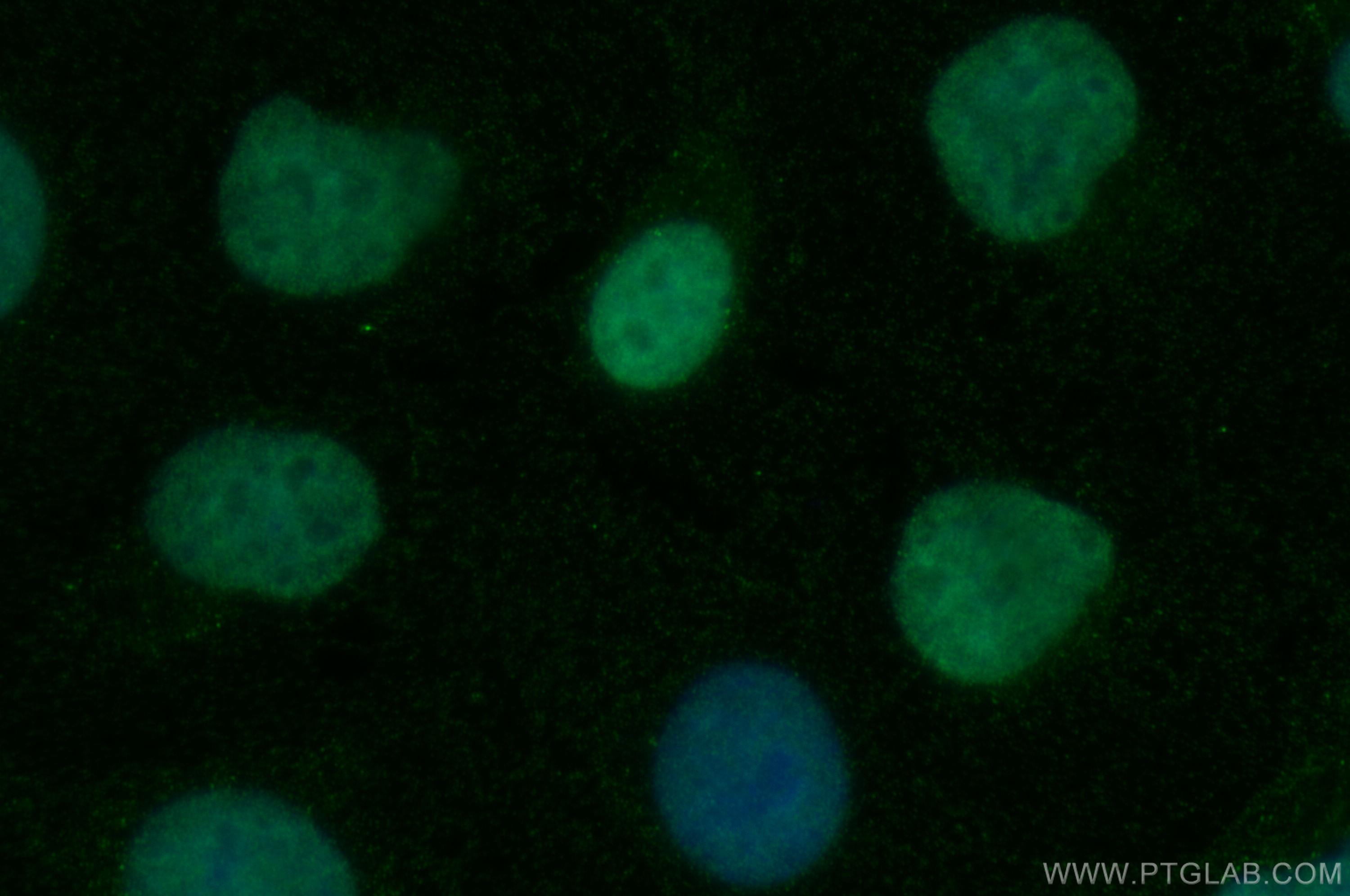 Immunofluorescence (IF) / fluorescent staining of U2OS cells using PSIP1 Monoclonal antibody (67723-1-Ig)