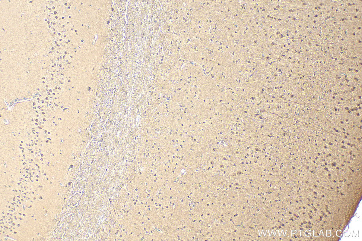 Immunohistochemistry (IHC) staining of mouse brain tissue using PSMA6 Polyclonal antibody (11573-1-AP)