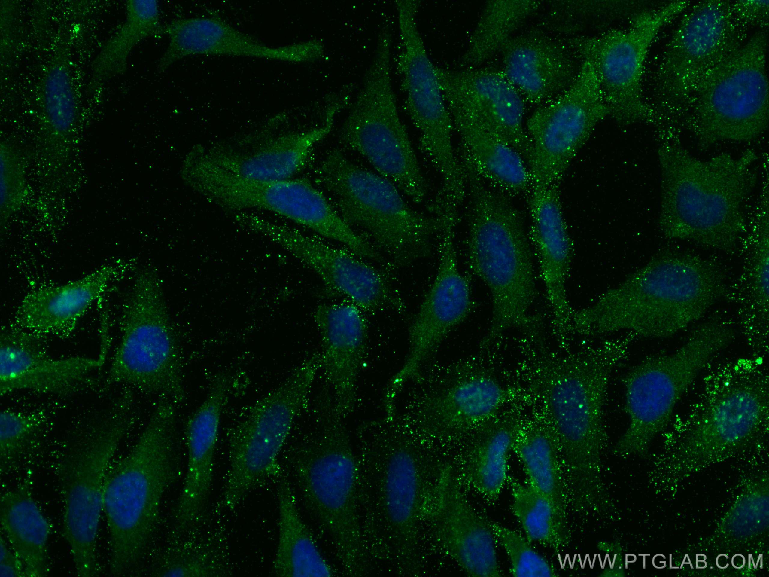 Immunofluorescence (IF) / fluorescent staining of HeLa cells using PSMA6 Monoclonal antibody (67695-1-Ig)