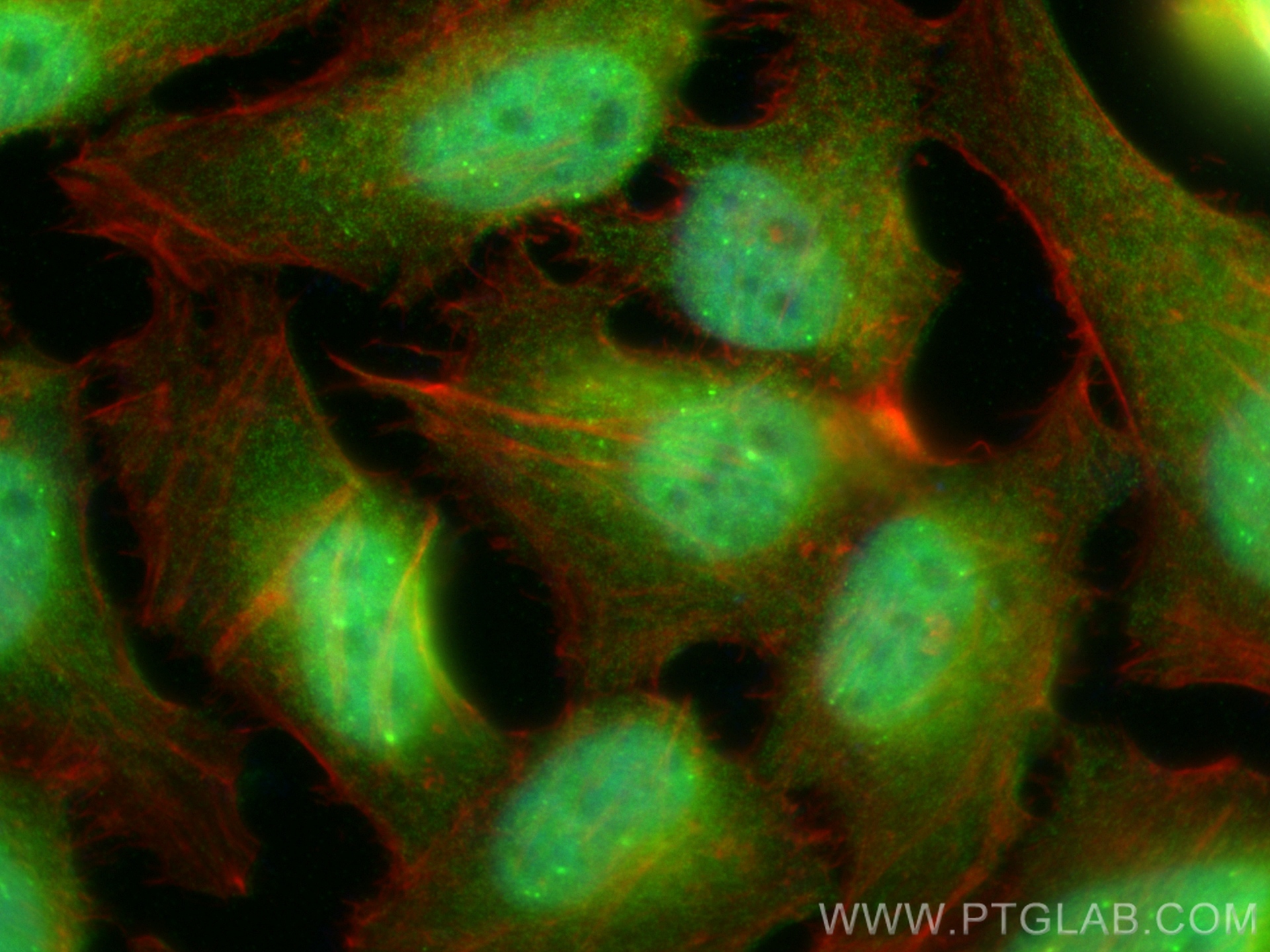 Immunofluorescence (IF) / fluorescent staining of HeLa cells using PSMA7 Polyclonal antibody (15219-1-AP)