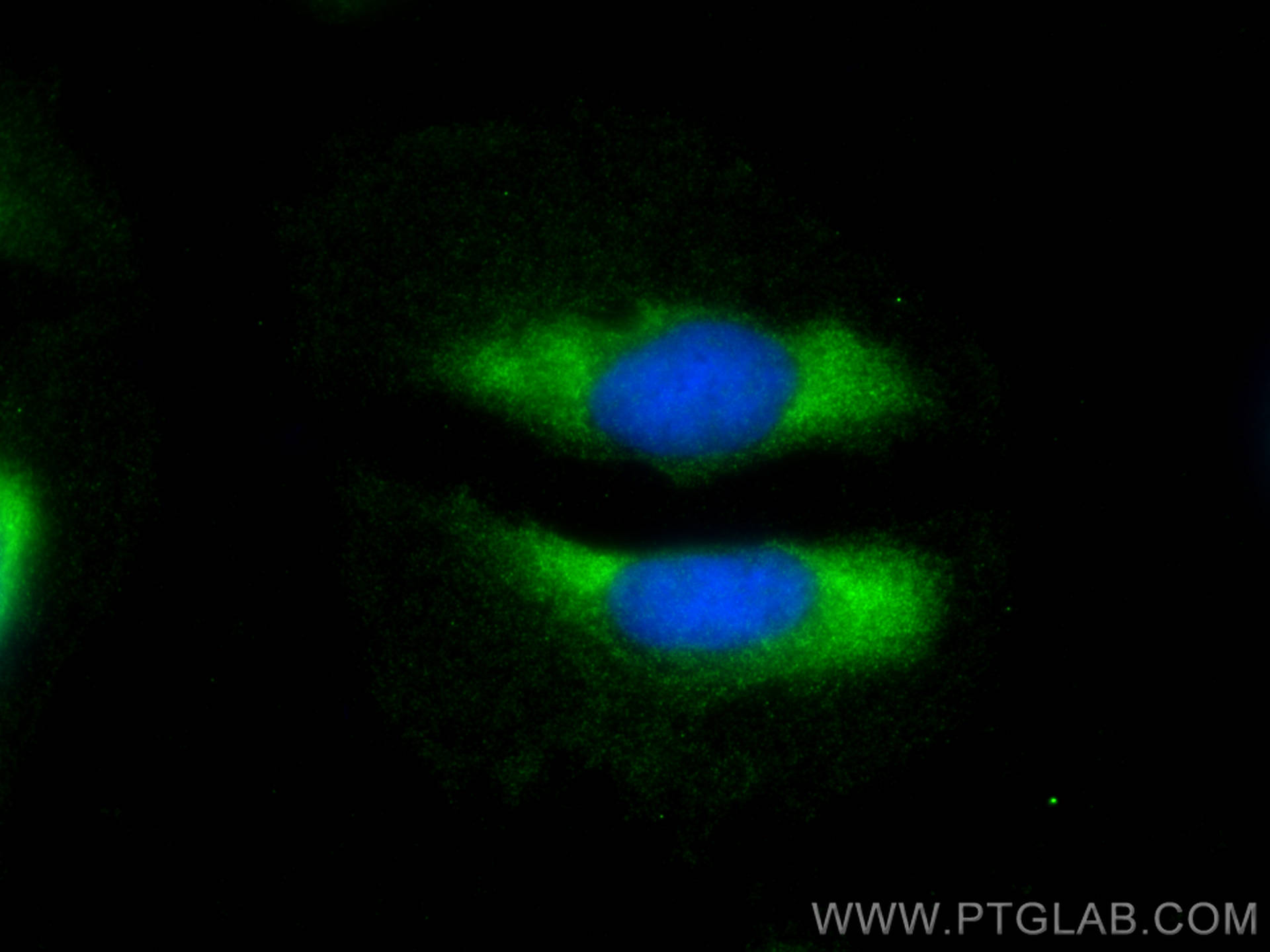 Immunofluorescence (IF) / fluorescent staining of U2OS cells using PSMB1 Polyclonal antibody (11749-1-AP)