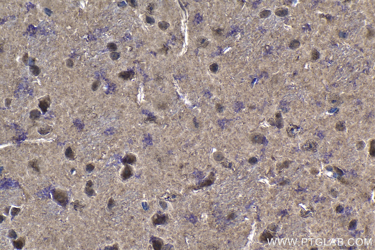 Immunohistochemistry (IHC) staining of mouse brain tissue using PSMB5 Polyclonal antibody (19178-1-AP)