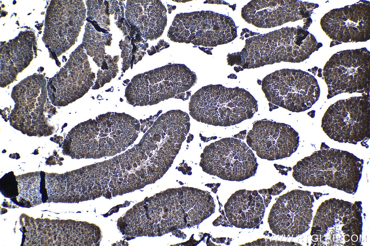 Immunohistochemistry (IHC) staining of mouse testis tissue using PSMB5 Polyclonal antibody (19178-1-AP)