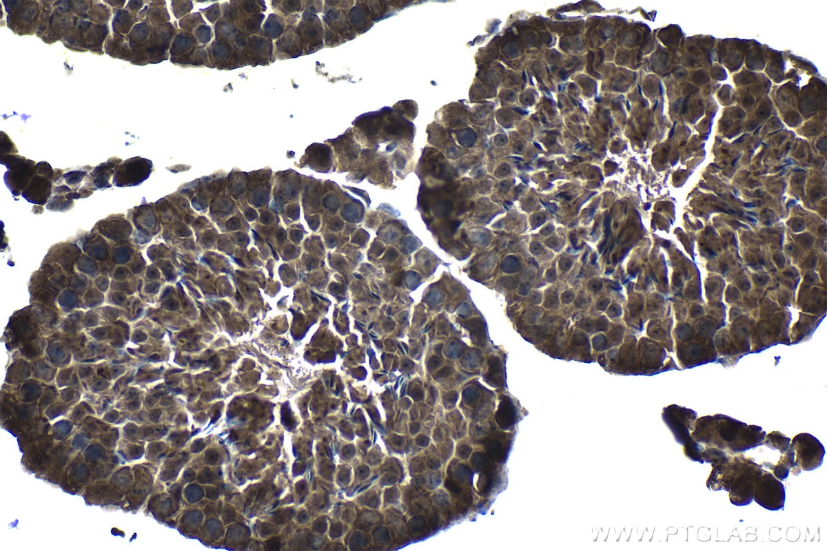 Immunohistochemistry (IHC) staining of mouse testis tissue using PSMB5 Polyclonal antibody (19178-1-AP)